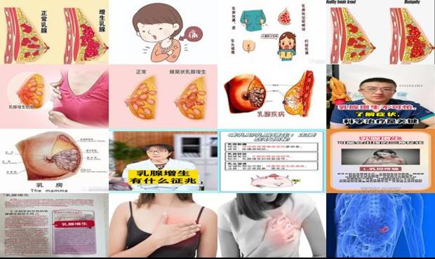 汕头乳腺增生严重症状