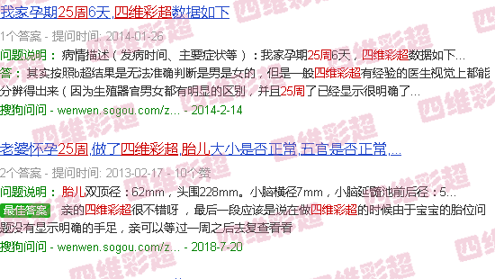 汕头25周胎儿四维彩超图