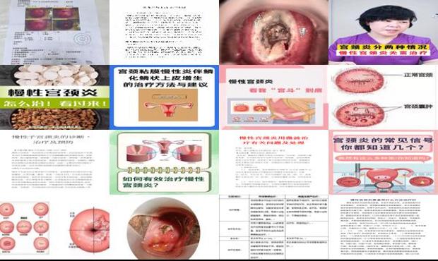 汕头慢性宫颈炎怎么治疗