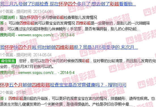 汕头怀孕4个月四维彩超