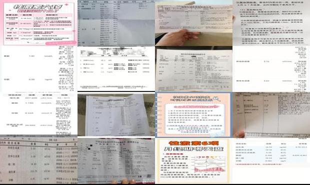 汕头性激素六项检查