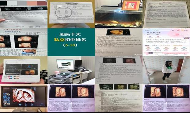 汕头四维多少周做*好