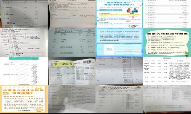 汕头六项激素检查多少钱