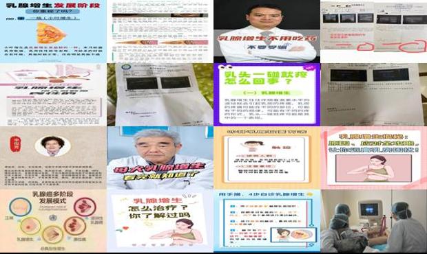 汕头乳腺增生如何检查
