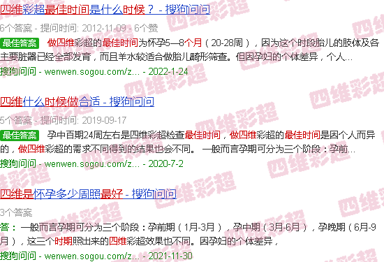 汕头几个月的时间做四维是*佳时期