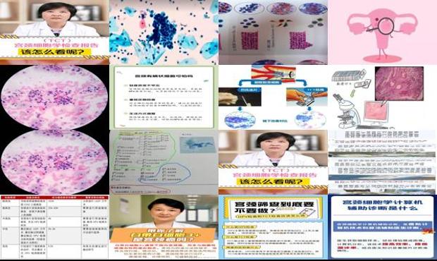 汕头宫颈细胞学检查