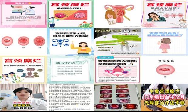 汕头宫颈糜烂可以自愈吗
