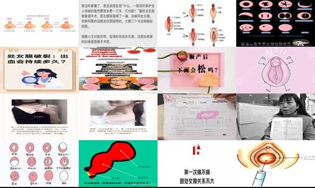 汕头处女模修复大概需要多长时间