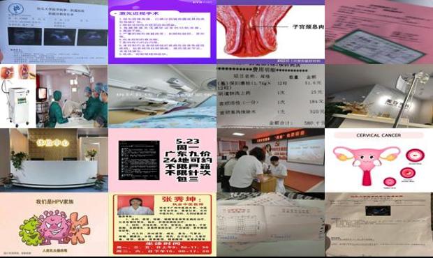 汕头做宫颈修复手术多少钱